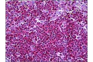 Human Spleen: Formalin-Fixed, Paraffin-Embedded (FFPE)