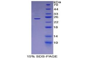 SDS-PAGE analysis of Human ADRP Protein. (ADRP Protéine)