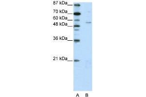 WB Suggested Anti-ZNF329 Antibody Titration:  2. (ZNF329 anticorps  (N-Term))