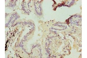 Immunohistochemistry of paraffin-embedded human lung tissue using ABIN7154897 at dilution of 1:100 (HSBP1 anticorps  (AA 1-75))