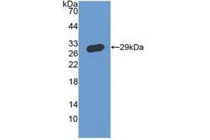 Detection of Recombinant IFNgR1, Human using Polyclonal Antibody to Interferon Gamma Receptor 1 (IFNgR1) (IFNGR1 anticorps  (AA 18-245))