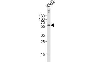 Western Blotting (WB) image for anti-Epsin 3 (EPN3) antibody (ABIN3002666)