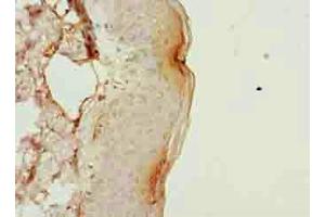 Immunohistochemistry of paraffin-embedded human skin tissue using ABIN7163544 at dilution of 1:100
