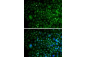 Immunofluorescence analysis of U20S cell using ANG antibody. (ANG anticorps  (AA 25-147))
