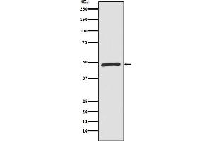 Western blot analysis of Zic1 expression in SW480 cell lysate.