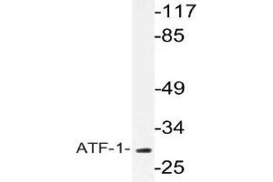 Western blot (WB) analysis of ATF-1 antibody in extracts from COLO cells.