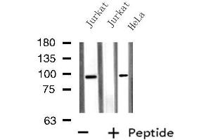Western blot analysis of extracts from HeLa/Jurkat cells, using PTPN22 antibody. (PTPN22 anticorps  (C-Term))