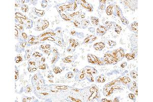 Immunohistochemistry (IHC) image for anti-Platelet/endothelial Cell Adhesion Molecule (PECAM1) (AA 28-601) antibody (ABIN7455156) (Recombinant CD31 anticorps  (AA 28-601))