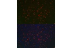 anti-Receptor Accessory Protein 2 (REEP2) (AA 93-252) antibody