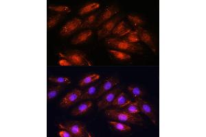 Immunofluorescence analysis of H9C2 cells using OTUB1 antibody (ABIN6128400, ABIN6145086, ABIN6145088 and ABIN6215346) at dilution of 1:100.