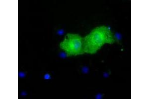 Anti-PKLR mouse monoclonal antibody (ABIN2453475) immunofluorescent staining of COS7 cells transiently transfected by pCMV6-ENTRY PKLR (RC206455). (PKLR anticorps)