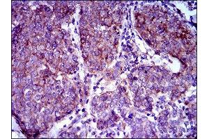 Immunohistochemistry (IHC) image for anti-ATP-Binding Cassette, Sub-Family B (MDR/TAP), Member 5 (ABCB5) (AA 481-674) antibody (ABIN1842667)