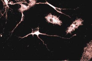 Immunofluorescent staining of Rat Neurons with anti-Adaptin gamma antibody. (gamma 1 Adaptin anticorps  (AA 642-821))
