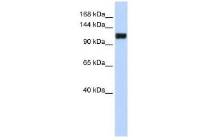 FAM120A antibody used at 1 ug/ml to detect target protein. (FAM120A anticorps  (Middle Region))