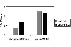 HeLa cells were treated or untreated with Calyculin A.