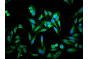 Immunofluorescence staining of Hela cells with ABIN7143230 at 1:100, counter-stained with DAPI. (ACOT1 anticorps  (AA 258-350))
