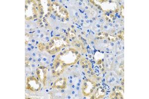 Immunohistochemistry of paraffin-embedded rat kidney using NDUFB10 antibody (ABIN5972156) at dilution of 1/100 (40x lens). (NDUFB10 anticorps)