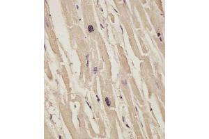 (ABIN6242834 and ABIN6578871) staining COL14A1 in human heart tissue sections by Immunohistochemistry (IHC-P - paraformaldehyde-fixed, paraffin-embedded sections). (COL14A1 anticorps  (AA 643-677))