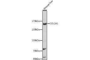 Western blot analysis of extracts of mouse liver, using COL2 antibody (560) at 1:1000 dilution. (COL2A1 anticorps  (AA 873-1072))