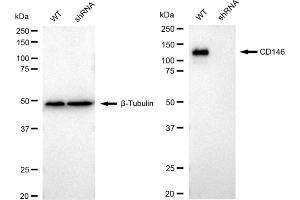 Western blotting analysis using CD146 antibody (ABIN7799362).