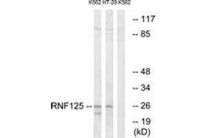 Western blot analysis of extracts from K562/HT-29 cells, using RNF125 Antibody. (RNF125 anticorps  (AA 131-180))