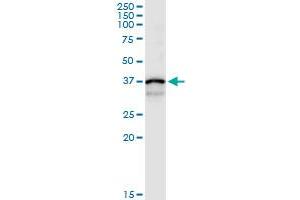 anti-Cathepsin S (CTSS) (AA 1-331) antibody
