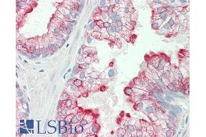 ABIN5539537 (5µg/ml) staining of paraffin embedded Human Prostate. (HRH3 anticorps  (Internal Region))