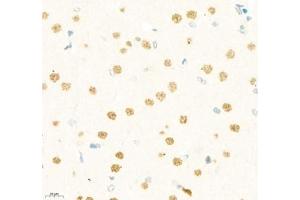 Immunohistochemistry of paraffin embedded rat brain using LDOCL (ABIN7075411) at dilution of 1:1400 (400x lens) (Retrotransposon Gag-Like Protein 6 (RTL6) anticorps)