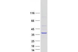 Validation with Western Blot