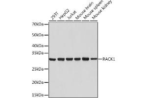 Western blot analysis of extracts of various cell lines, using R Rabbit mAb (ABIN1679360, ABIN3018118, ABIN3018119 and ABIN7101576) at 1:1000 dilution.