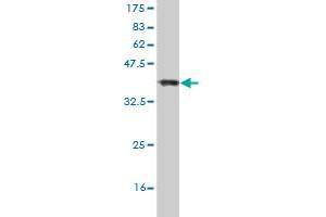 Western Blot detection against Immunogen (37. (HIPK2 anticorps  (AA 961-1065))