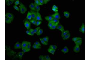 Immunofluorescence staining of HepG2 cells with ABIN7155567 at 1:66, counter-stained with DAPI. (HLA-C anticorps  (AA 200-306))