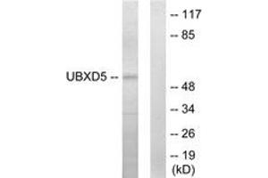 Western Blotting (WB) image for anti-UBX Domain Protein 11 (UBXN11) (AA 131-180) antibody (ABIN2889637) (UBXN11 anticorps  (AA 131-180))