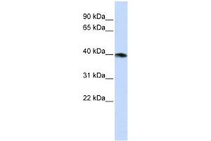 GNAZ antibody used at 1 ug/ml to detect target protein.