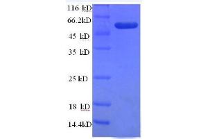 Tumor Necrosis Factor (Ligand) Superfamily, Member 10 (TNFSF10) (AA 39-281) protein (GST tag)