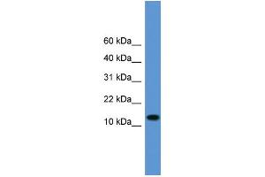 WB Suggested Anti-TAC1 Antibody Titration: 1. (TAC1 anticorps  (Middle Region))