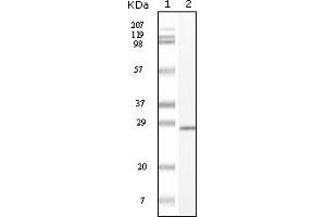 Western Blotting (WB) image for anti-Mast/stem Cell Growth Factor Receptor (KIT) (truncated) antibody (ABIN2464038) (KIT anticorps  (truncated))