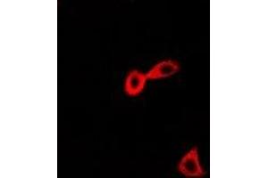 Immunofluorescent analysis of CARS staining in Hela cells. (CARS anticorps)
