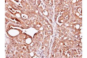 IHC-P Image Immunohistochemical analysis of paraffin-embedded NCI-N87 xenograft, using PAPSS1, antibody at 1:100 dilution.