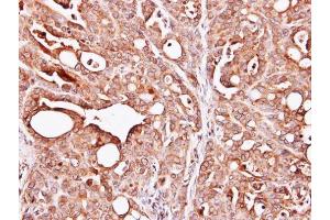 IHC-P Image Immunohistochemical analysis of paraffin-embedded NCI-N87 xenograft, using PAPSS1, antibody at 1:100 dilution. (PAPSS1 anticorps)
