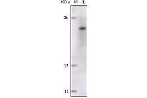 Western Blot showing FES antibody used against truncated FES recombinant protein. (FES anticorps)