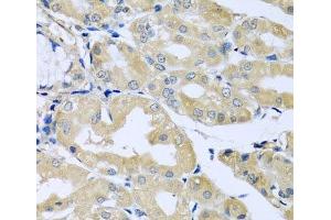 Immunohistochemistry of paraffin-embedded Human stomach using HS1BP3 Polyclonal Antibody at dilution of 1:100 (40x lens). (HS1BP3 anticorps)