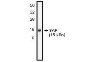 Image no. 1 for anti-SH2 Domain Containing 1A (SH2D1A) antibody (ABIN1502673) (SH2D1A anticorps)