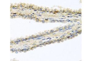 Immunohistochemistry of paraffin-embedded Human prostate using GPLD1 Polyclonal Antibody at dilution of 1:100 (40x lens). (GPLD1 anticorps)