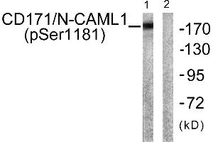 Western blot analysis of extracts from K562 cells, using CD171/N-CAML1 (Phospho-Ser1181) antibody. (L1CAM anticorps  (pSer1181))