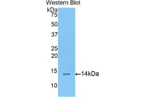 Western blot analysis of the recombinant protein. (Corin anticorps  (AA 533-634))