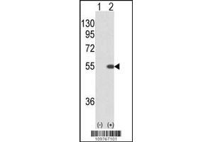 Western blot analysis of STK40 using rabbit polyclonal STK40 using 293 cell lysates (2 ug/lane) either nontransfected (Lane 1) or transiently transfected with the STK40 gene (Lane 2). (STK40 anticorps  (C-Term))