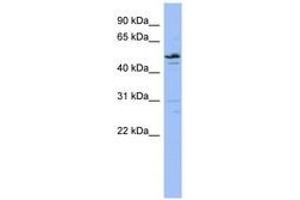 Image no. 1 for anti-Zinc Finger Protein 419 (ZNF419) (AA 107-156) antibody (ABIN6742639) (ZNF419 anticorps  (AA 107-156))