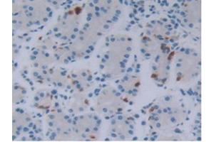 IHC-P analysis of Human Stomach Tissue, with DAB staining. (FGF18 anticorps  (AA 10-199))
