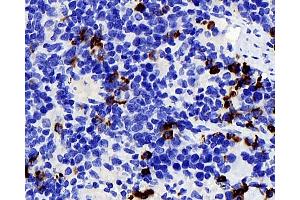 Immunohistochemistry analysis of parafffin-embedded mouse spleen using P2RX3 Polyclonal Antibody at dilution of 1:400. (P2RX3 anticorps)